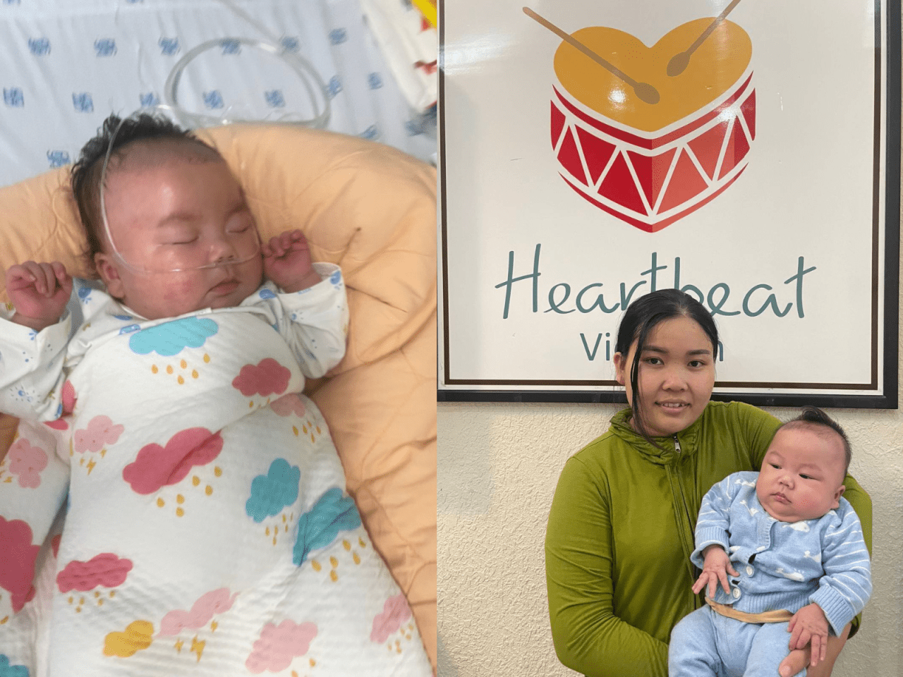 The journey to bring a premature baby with congenital heart defects home