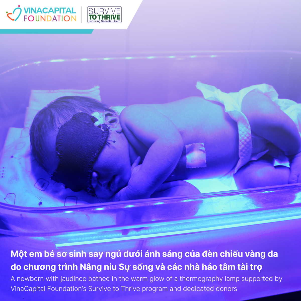 Nâng niu Sự sống trao khởi đầu mới cho em bé sơ sinh mắc bệnh vàng da tại Điện Biên Đông