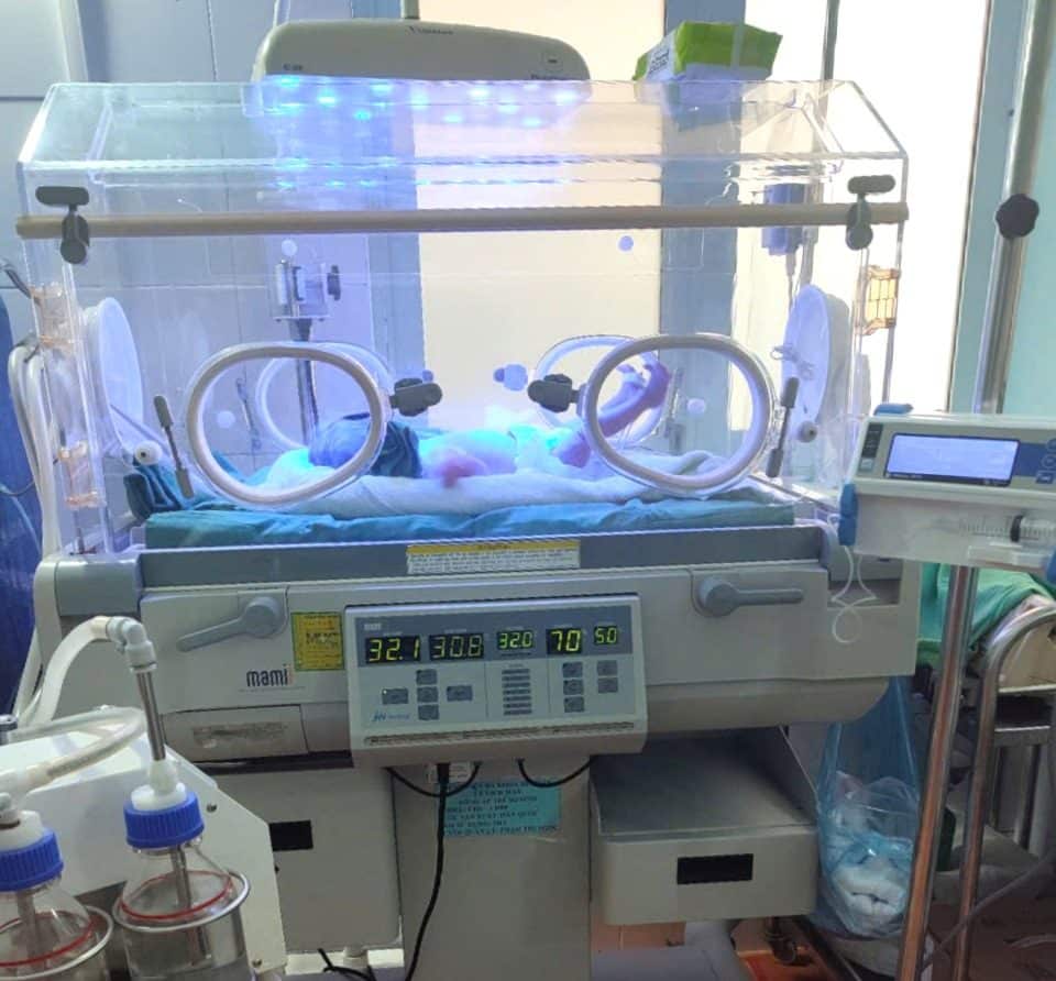 Timely life-saving opportunities for premature babies in Xin Man