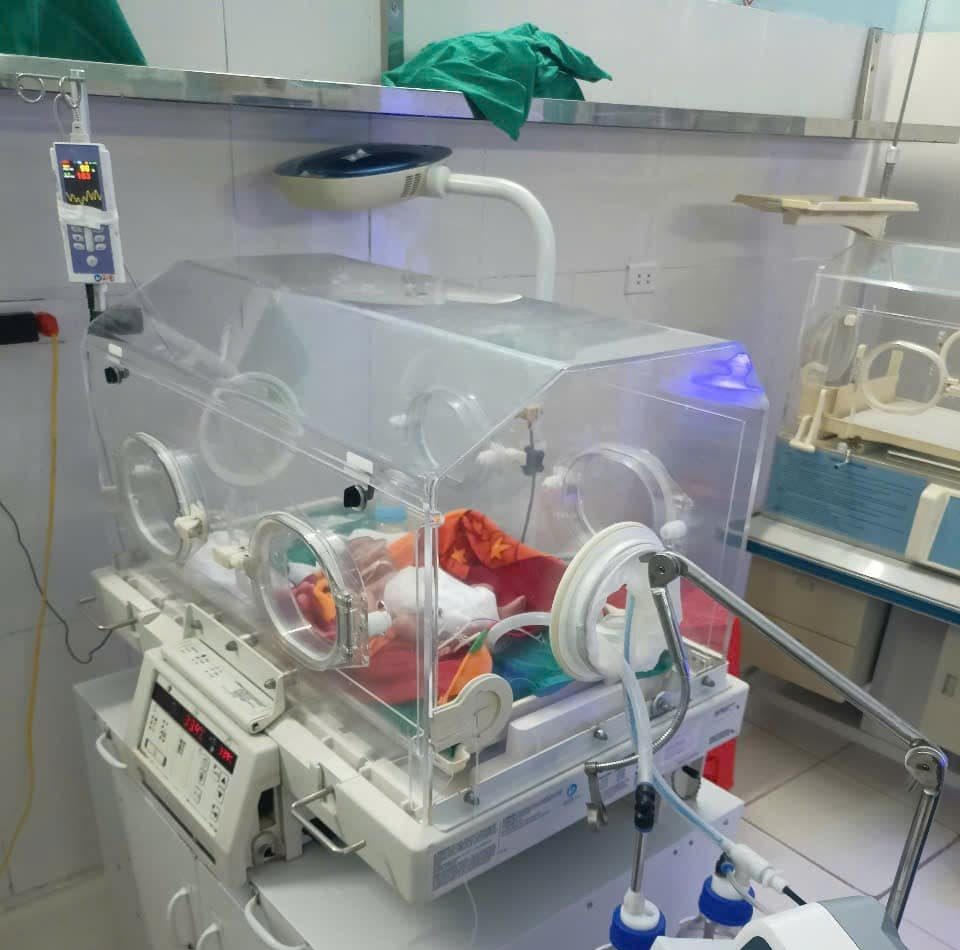 Hai em bé song sinh san sẻ từng nhịp thở từ một chiếc máy CPAP